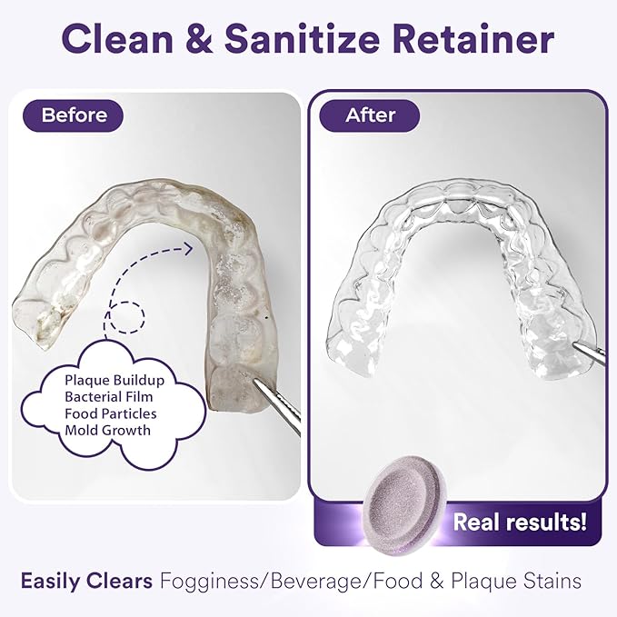 Weiss Naturals Retainer Cleaner Tablets, Invisalign Cleaner, Remove Stains, Odors & Plaque, PERSULFATE FREE Night Guard & Denture Cleaner 2-Month Supply, 60 Grape Scented Tablets
