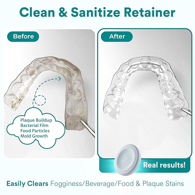Weiss Naturals Retainer Cleaner Tablets, Remove Stains, Odors & Plaque, PERSULFATE FREE Night Guard & Denture Cleaner 8-Month Supply, 240 Mint Scented Tablets