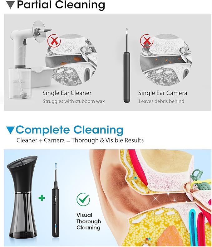 KAUGIC Ear Wax Removal Kit with Camera – Ear Cleaner Tool for Safe & Effective Ear Care – Includes Ear Camera for Visual Inspection & Gentle Ear Irrigation System – Complete Ear Cleaning Solution