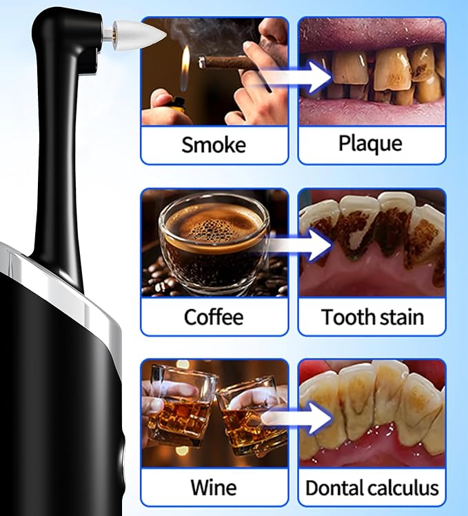 Coobest Tooth Polisher Kit with 5 Speed Modes and 5 Heads, Tooth Whitening for Cleaning with LED Light, IPX7 Waterproof Tooth Polish Complete Teeth Cleaning Tools Home Dental Care Set Black