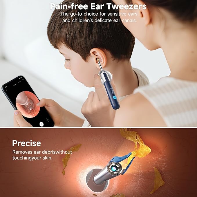 BEBIRD R1 Ultra Ear Wax Removal, Ear Cleaner with Camera, Wax Remove Ear Pick with Ear Tweezers, Visual Dropper Cleaning Kit, Ear/Nose/Throat Tool for Family, Blue