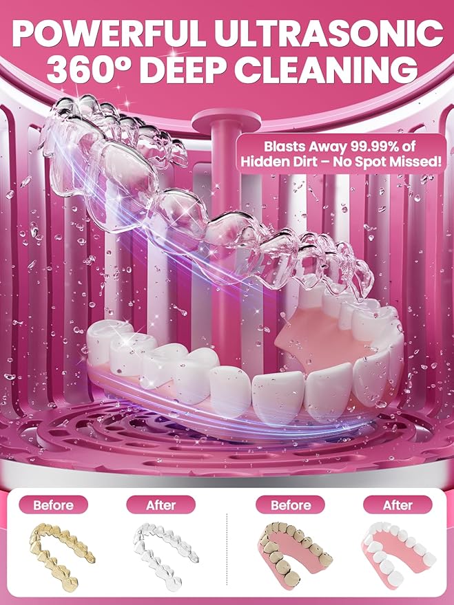 Dental Ultrasonic Retainer Cleaner Machine: Nicwell 200ML Dental Cleaning Pod for Denture, Mouth Guard, Night Guard, Braces, Tray, Aligner 45kHz Cleaner with Protection Design & Digital Timer
