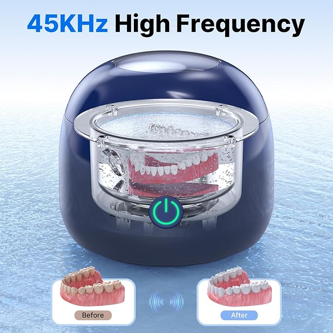 CXRUY Ultrasonic Retainer Cleaner - UV Dental Cleaning Pod Night Guard Cleaner for Dentures, Aligner, Braces, Toothbrush Heads, Jewelry (Navy Blue)