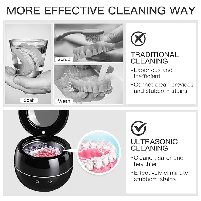 Dental Ultrasonic Retainer Cleaner Machine: 45kHz Dental Cleaning Pod for Denture, Aligner, Mouth Guard, Night Guard, Braces & Jewelry, UV Denture Cleaner with Digital Timer & Dual Mode 250ML Black