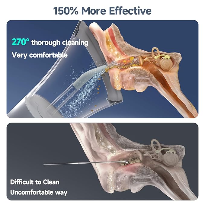 Ear Wax Removal, Electric Ear Cleaning Kit Effective & Safe Ear Cleaner Irrigation Flushing System 4 Pressure Modes for Ear Wax Buildup, Water Resistant Ear Cleaning Tool USB Rechargeable