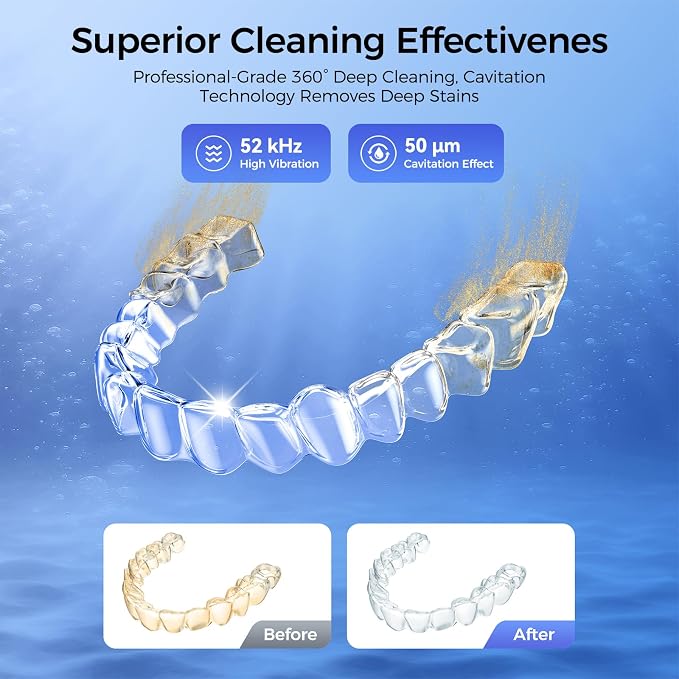 CALOTO Ultrasonic Retainer Cleaner Machine, 52kHz Ultrasonic Denture Cleaner for Night Guards, Braces, Aligner, Toothbrush, Jewelry and More, Dental Cleaning Pod with Digital Timer & 250ML, Black