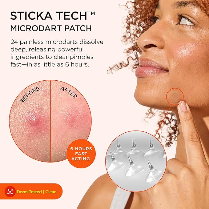 ZitSticka Killa Microdart Pimple Patches for Face - Most Potent Pimple Patch with Fast-Acting Microdarts - For Deep, Early-Stage Zits with Salicylic Acid - Regular 20 Count with Cleaning Swab