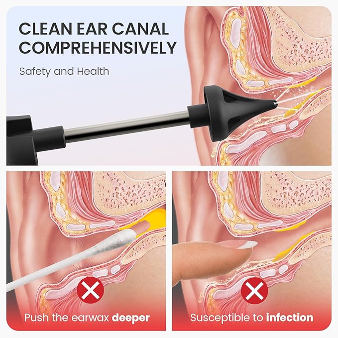 Ear Wax Removal Kit, Ear Cleaner Earwax Removal, Ear Wax Removal Tool, Superior IPX5 Waterproof, 4 Safe and Sufficient Power Pressure Settings, 6 Pcs Ear Pick (Grey)
