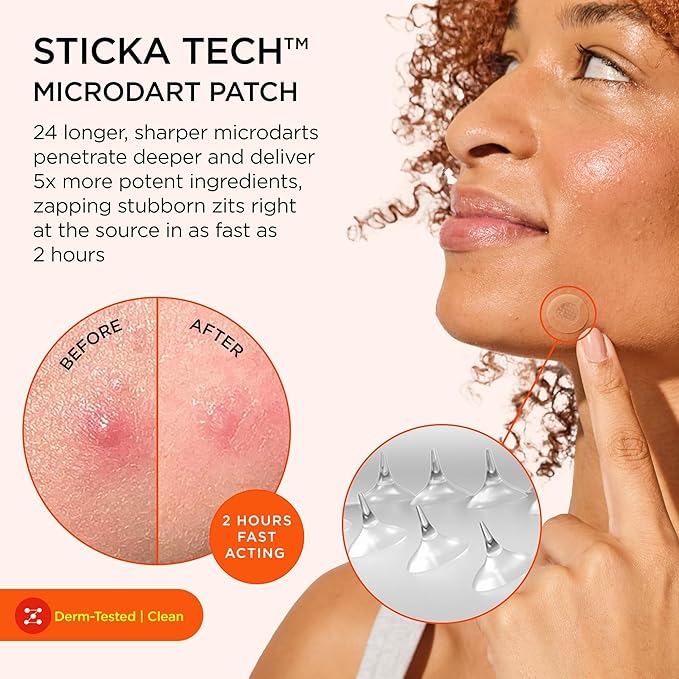 ZitSticka Extra Strength Killa Acne Microdart Patches for Face - OTC Acne Treatment with 2% Salicylic Acid - Fast Acting Microdarts for Deep, Early-Stage Zits & Blemish - 4 Count