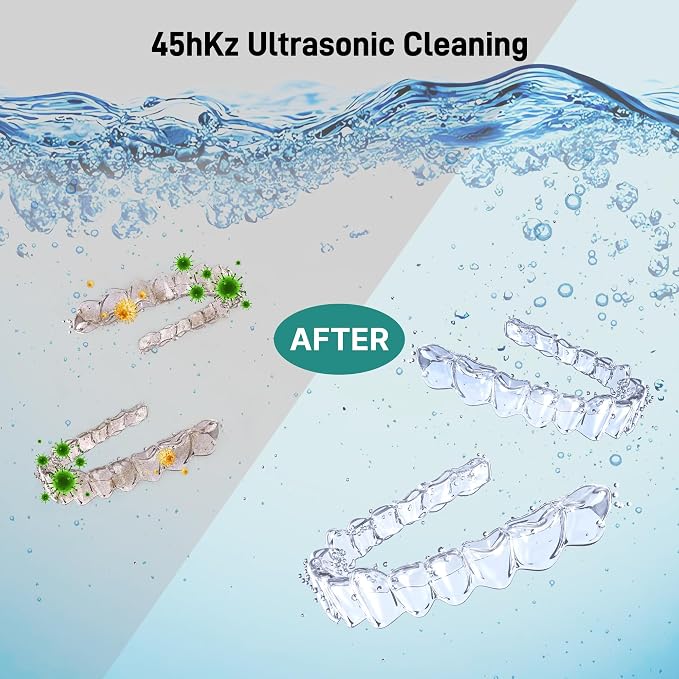 Ultrasonic Retainer Cleaner, Dental Cleaning Pod with U-V Lights, 45kHz Retainer Cleaner Machine for Dentures, Toothbrush Heads, Jewelry, Aligner, Night Mouth Guards (Black)