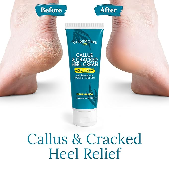 Urea Cream 40 Percent for Feet Maximum Strength Cracked Heel Treatment Foot Cream for Calluses and Dry Feet, Enriched with Shea Butter & Aloe for Moisturizing, Made in USA