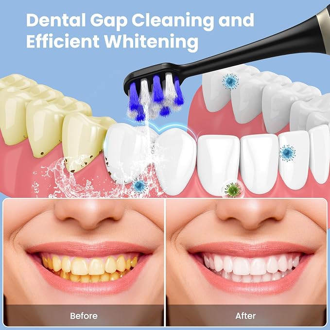 Electric Toothbrush with Water flosser, 2 in 1 Teeth Cleaning Kit, Toothbrush and Water flosser Combo, Travel Toothbrush with Water Bottle(Black)