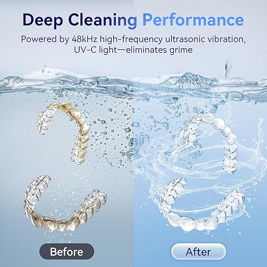 Ultrasonic Retainer Cleaner Machine 48kHz, Dental Cleaning Pod, Ultrasonic Retainer Cleaner for Dentures, Aligners, Mouth Guards, Toothbrush Heads and Jewelry with 200ML Capacity, LAB Supply
