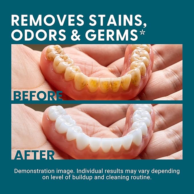 Denture Bath Case and Retainer Case, Denture Bath Cup for Invisalign Retainers Mouthguards Dentures Cleaner Kit with Strainer Spill-Free Portable Retainer Cleaner Case by M3 Naturals (Pack of 2)