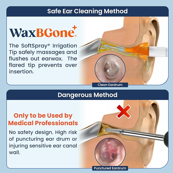 WaxBGone Ear Wax Removal Kit with SoftSpray Irrigation Tips, 4X High Output Sprayer & Ear Basin - Safe, Fast, Gentle Ear Cleaning Kit for Adults & Kids at Home - Premium Kit with Otoscope + Ear Drops