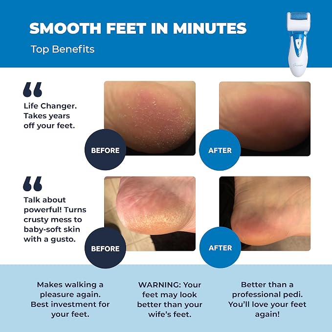 Electric Callus Remover: Rechargeable Electronic Foot File CR900 by Own Harmony (Powerful Motor) Best Pedicure Tools w 3 Rollers Professional Pedi Feet Care Sander for Cracked Heels and Hard Skin