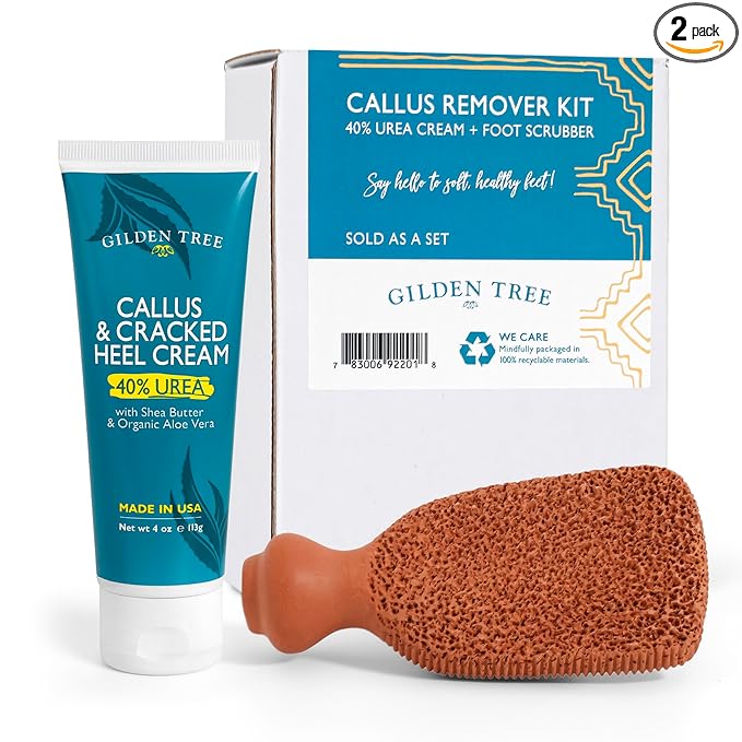 Foot Callus Remover Kit - 40% Urea Cream & Handmade Terra-Cotta Pumice Stone for Feet - Callus Remover for Feet with Shea Butter & Aloe Vera - Cracked Heel Treatment & Moisturizer